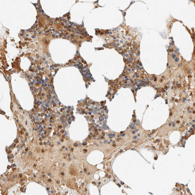 TNK1 Antibody in Immunohistochemistry (Paraffin) (IHC (P))