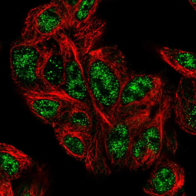 PHYHD1 Antibody in Immunocytochemistry (ICC/IF)