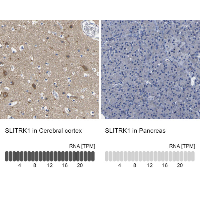 SLITRK1 Antibody in Immunohistochemistry (Paraffin) (IHC (P))