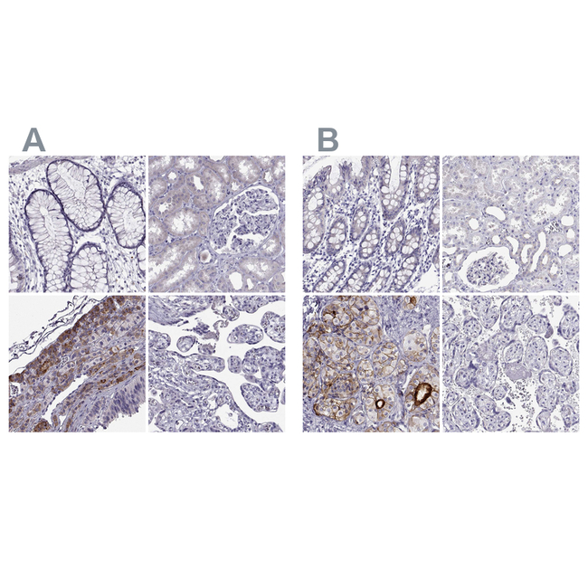 IGSF1 Antibody in Immunohistochemistry (Paraffin) (IHC (P))