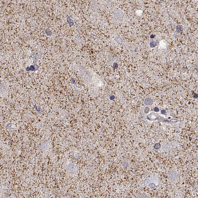 Dopamine Transporter Antibody in Immunohistochemistry (Paraffin) (IHC (P))