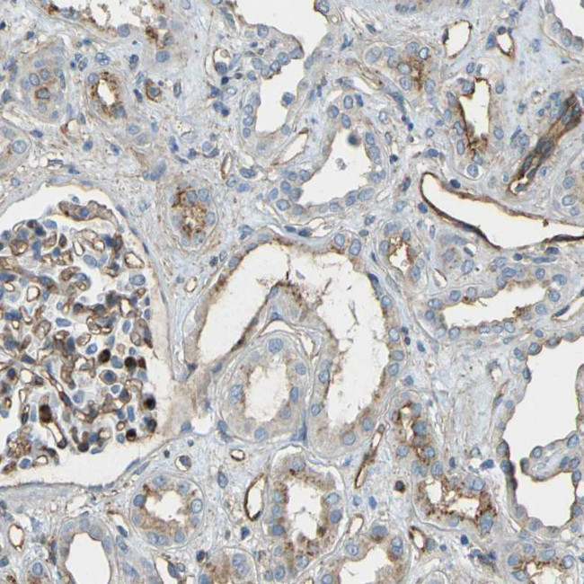 TEM7 Antibody in Immunohistochemistry (Paraffin) (IHC (P))