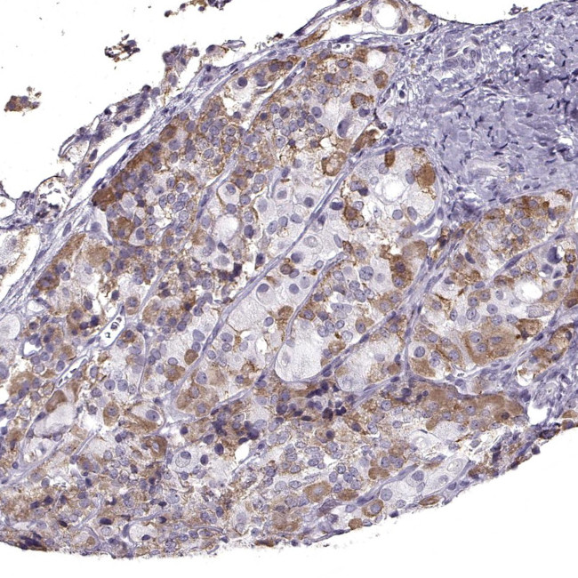 GnRHR Antibody in Immunohistochemistry (Paraffin) (IHC (P))