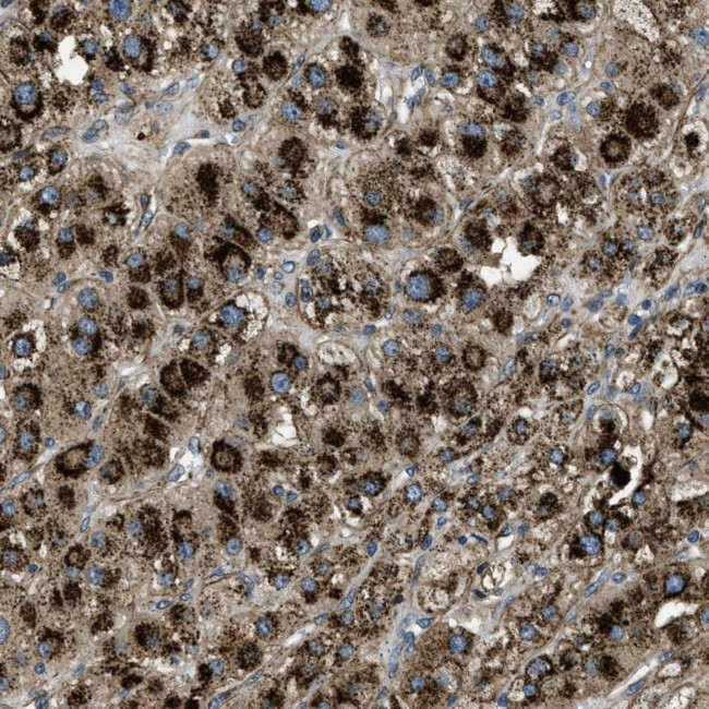 GNS Antibody in Immunohistochemistry (Paraffin) (IHC (P))