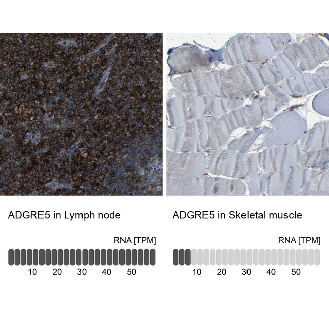 CD97 Antibody in Immunohistochemistry (Paraffin) (IHC (P))