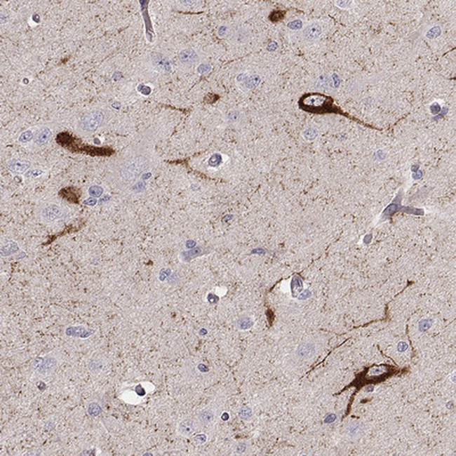 TAC1 Antibody in Immunohistochemistry (Paraffin) (IHC (P))