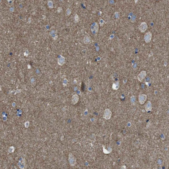 GluR6 Antibody in Immunohistochemistry (Paraffin) (IHC (P))
