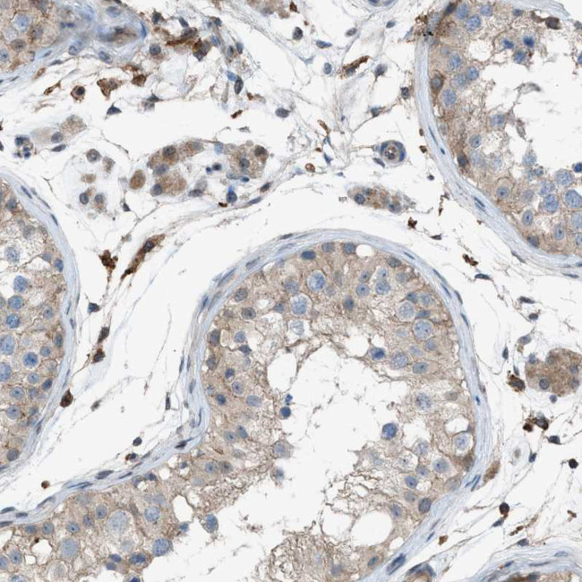 DYRK1A Antibody in Immunohistochemistry (Paraffin) (IHC (P))