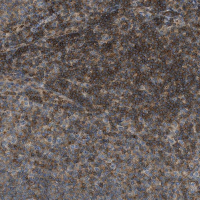 GRK6 Antibody in Immunohistochemistry (Paraffin) (IHC (P))