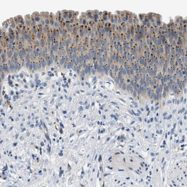 EMR3 Antibody in Immunohistochemistry (Paraffin) (IHC (P))