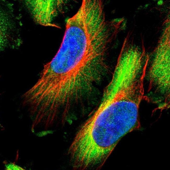 HSPB8 Antibody in Immunocytochemistry (ICC/IF)