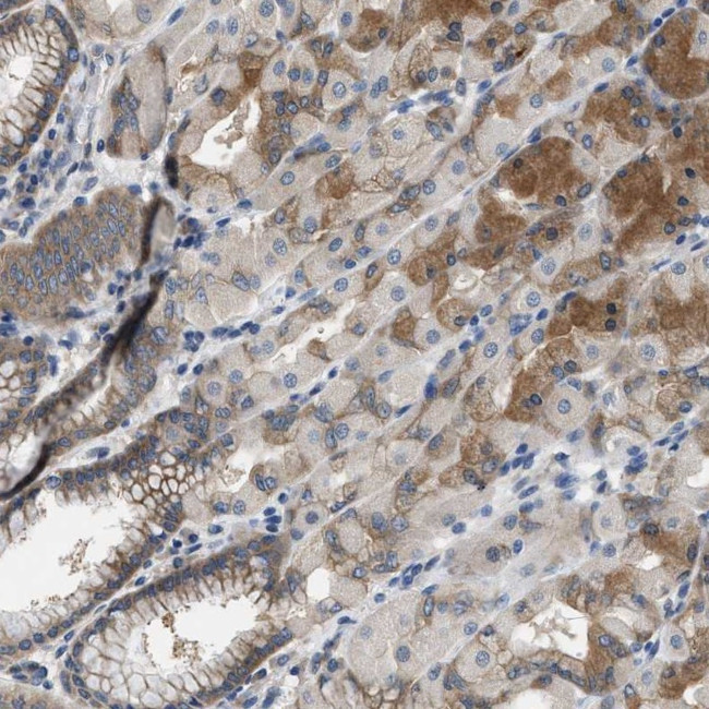 TRIP15 Antibody in Immunohistochemistry (Paraffin) (IHC (P))