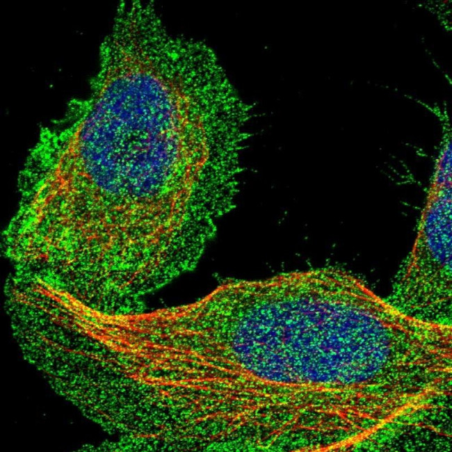 DCBLD2 Antibody in Immunocytochemistry (ICC/IF)