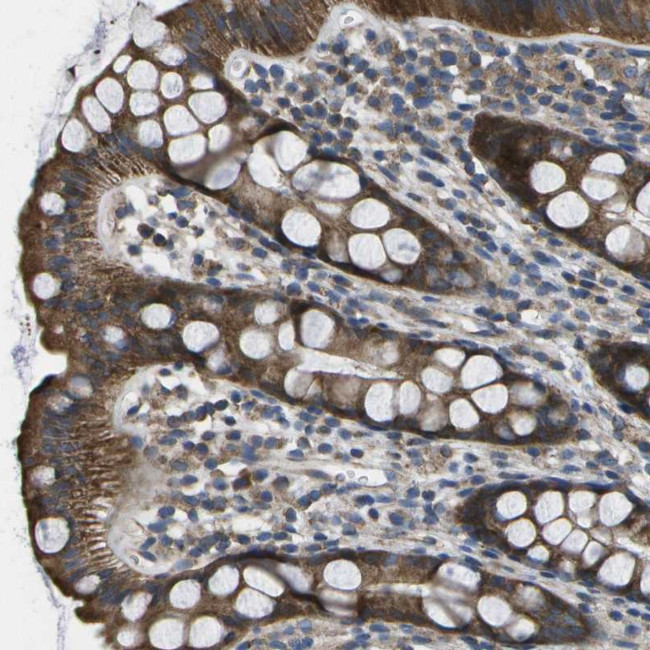 MVK Antibody in Immunohistochemistry (Paraffin) (IHC (P))