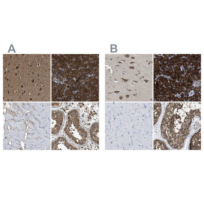 YARS Antibody in Immunohistochemistry (Paraffin) (IHC (P))