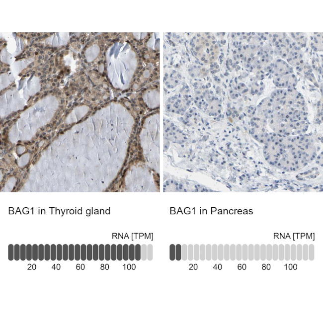 BAG1 Antibody in Immunohistochemistry (Paraffin) (IHC (P))