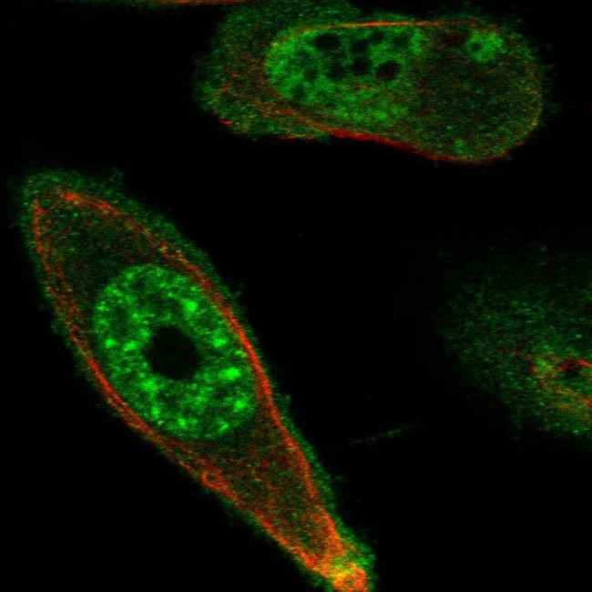 DRAK1 Antibody in Immunocytochemistry (ICC/IF)