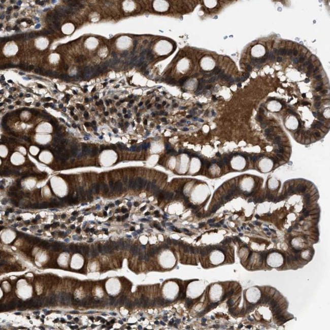 TRIP15 Antibody in Immunohistochemistry (Paraffin) (IHC (P))