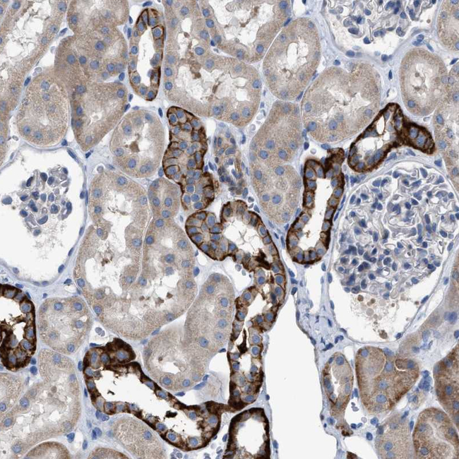LGP2 Antibody in Immunohistochemistry (Paraffin) (IHC (P))