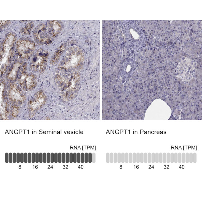 Angiopoietin 1 Antibody in Immunohistochemistry (Paraffin) (IHC (P))