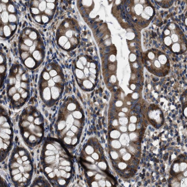 Angiopoietin 1 Antibody in Immunohistochemistry (Paraffin) (IHC (P))
