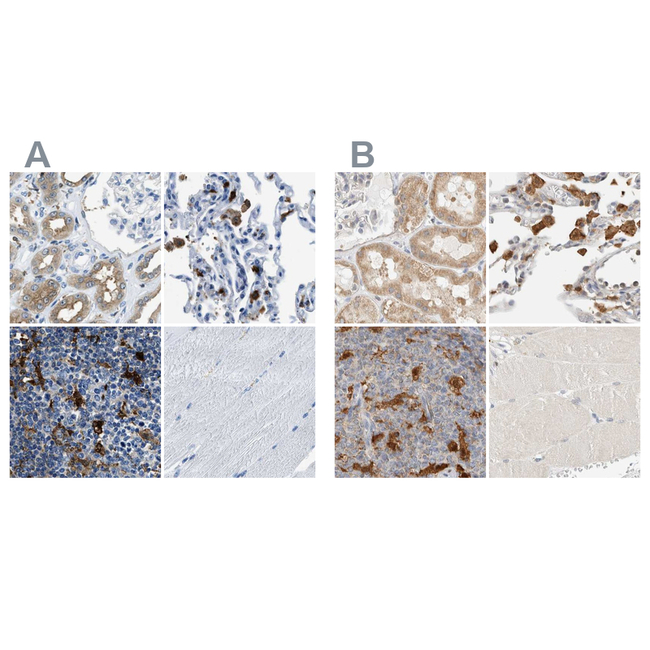 CAPG Antibody in Immunohistochemistry (Paraffin) (IHC (P))