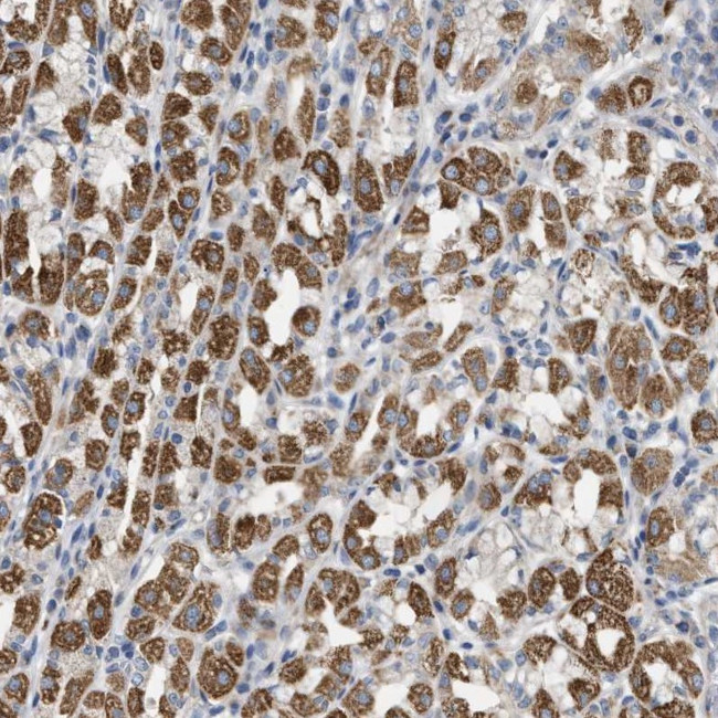 LGP2 Antibody in Immunohistochemistry (Paraffin) (IHC (P))