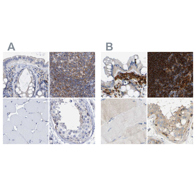 FNBP1 Antibody in Immunohistochemistry (Paraffin) (IHC (P))