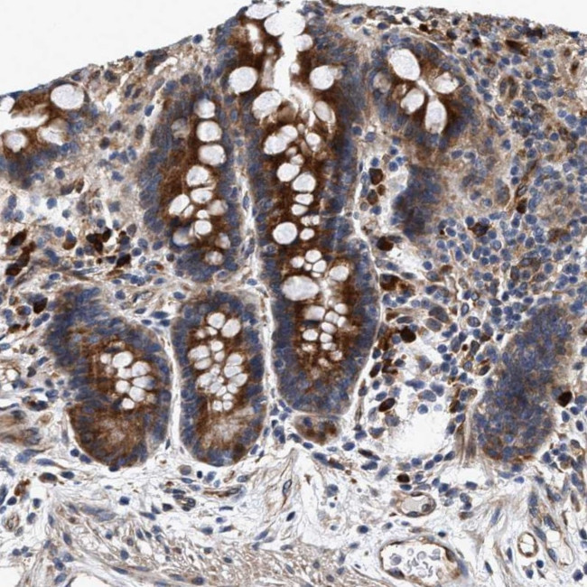 CMG1 Antibody in Immunohistochemistry (Paraffin) (IHC (P))