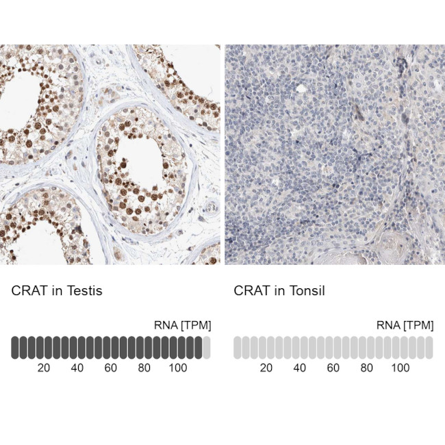 CAT1 Antibody in Immunohistochemistry (Paraffin) (IHC (P))