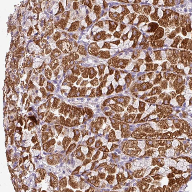 VAM1 Antibody in Immunohistochemistry (Paraffin) (IHC (P))