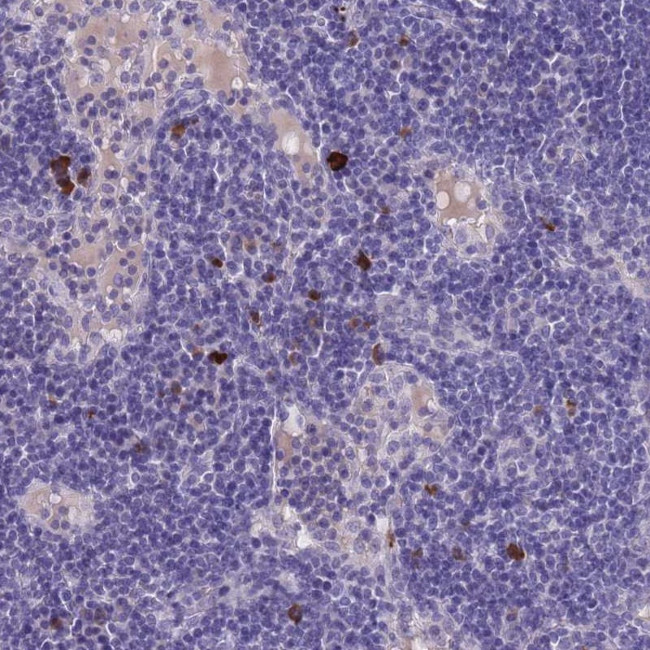 ASAP3 Antibody in Immunohistochemistry (Paraffin) (IHC (P))