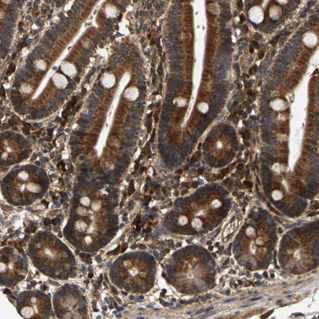CIDEC Antibody in Immunohistochemistry (Paraffin) (IHC (P))