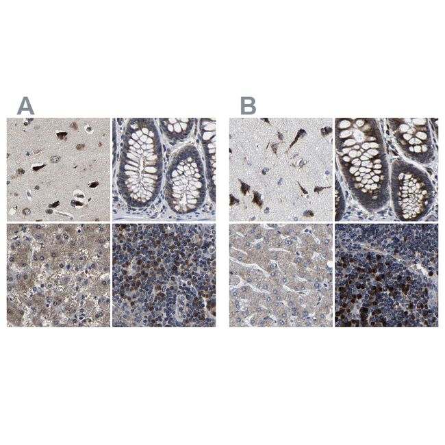 RCAS1 Antibody in Immunohistochemistry (Paraffin) (IHC (P))