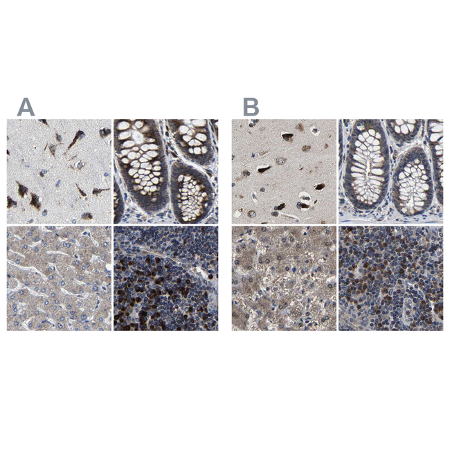 RCAS1 Antibody in Immunohistochemistry (Paraffin) (IHC (P))