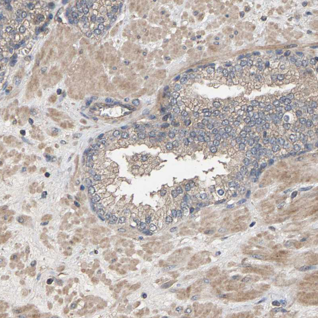 HTRA3 Antibody in Immunohistochemistry (Paraffin) (IHC (P))