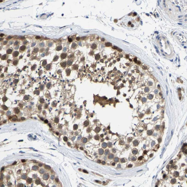 KLHL1 Antibody in Immunohistochemistry (Paraffin) (IHC (P))