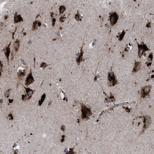 PPT1 Antibody in Immunohistochemistry (Paraffin) (IHC (P))