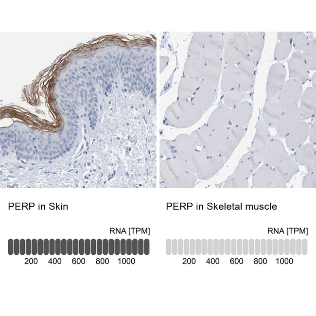 PERP Antibody in Immunohistochemistry (Paraffin) (IHC (P))