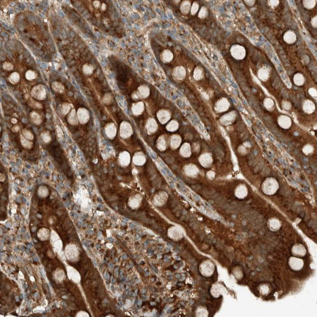 EXOC7 Antibody in Immunohistochemistry (Paraffin) (IHC (P))