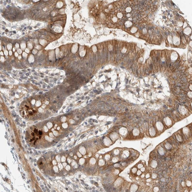 ZBTB2 Antibody in Immunohistochemistry (Paraffin) (IHC (P))
