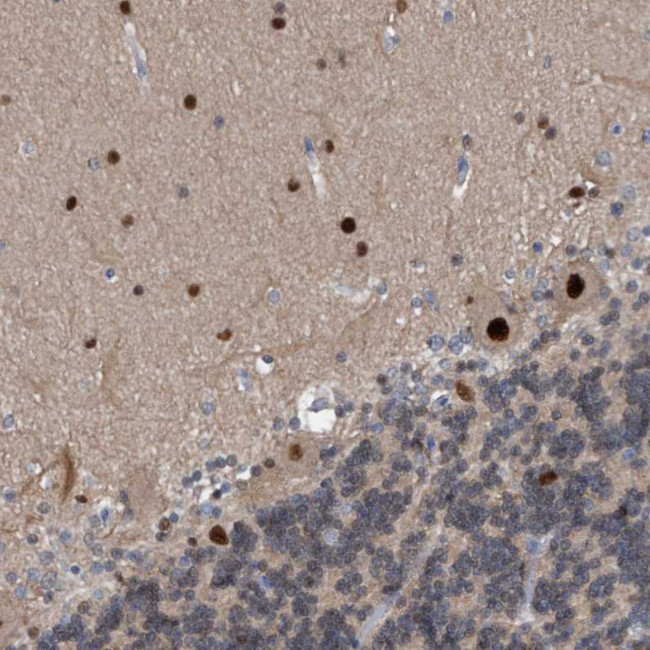 PINX1 Antibody in Immunohistochemistry (Paraffin) (IHC (P))