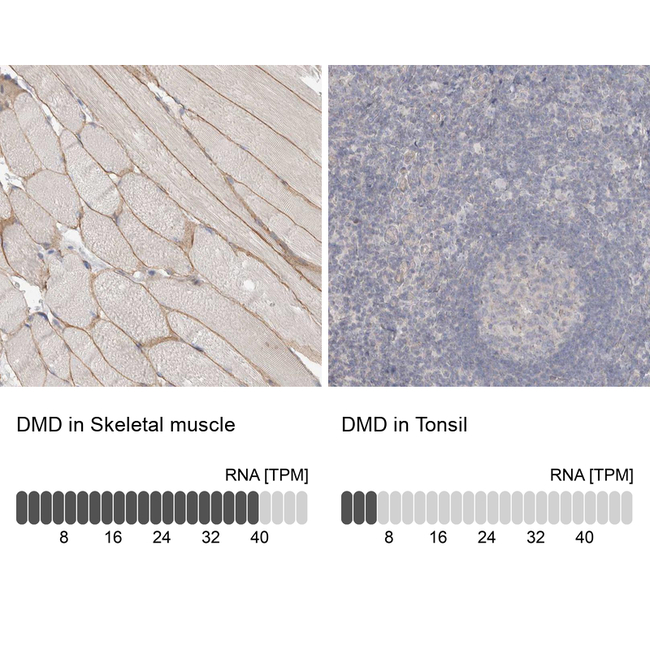 Dystrophin Antibody in Immunohistochemistry (Paraffin) (IHC (P))