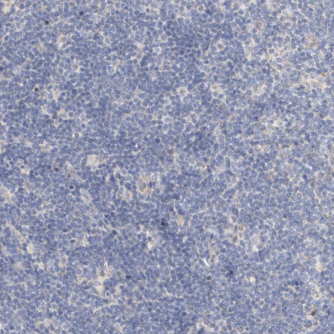 Protein S Antibody in Immunohistochemistry (Paraffin) (IHC (P))