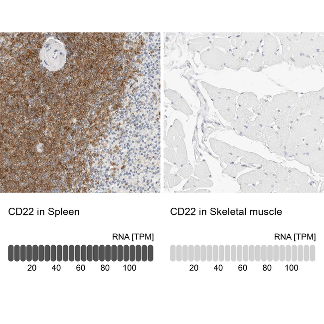 CD22 Antibody in Immunohistochemistry (Paraffin) (IHC (P))