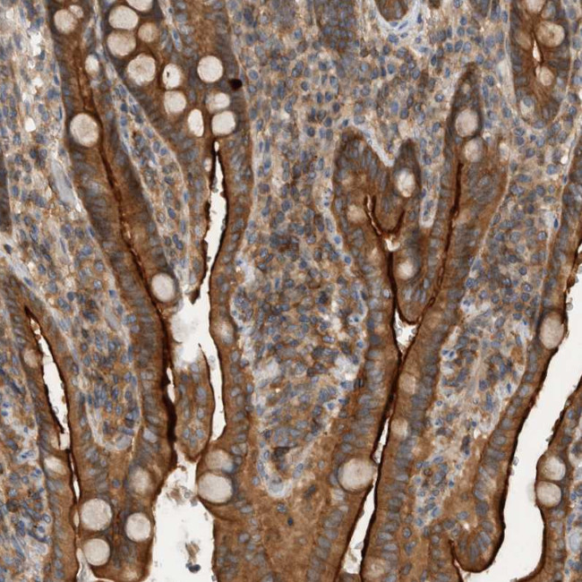 SCARA5 Antibody in Immunohistochemistry (Paraffin) (IHC (P))