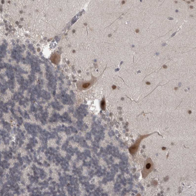 MTBP Antibody in Immunohistochemistry (Paraffin) (IHC (P))