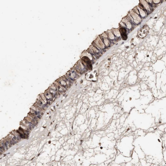 VLK Antibody in Immunohistochemistry (Paraffin) (IHC (P))