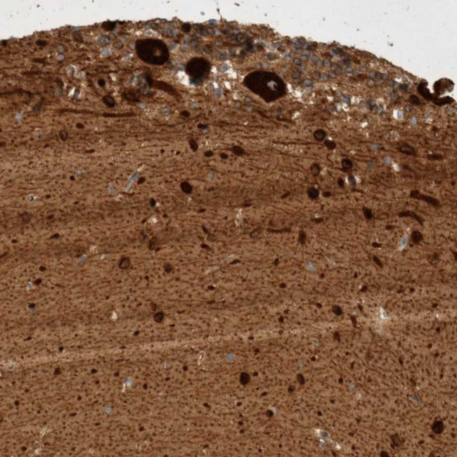 GPR150 Antibody in Immunohistochemistry (Paraffin) (IHC (P))