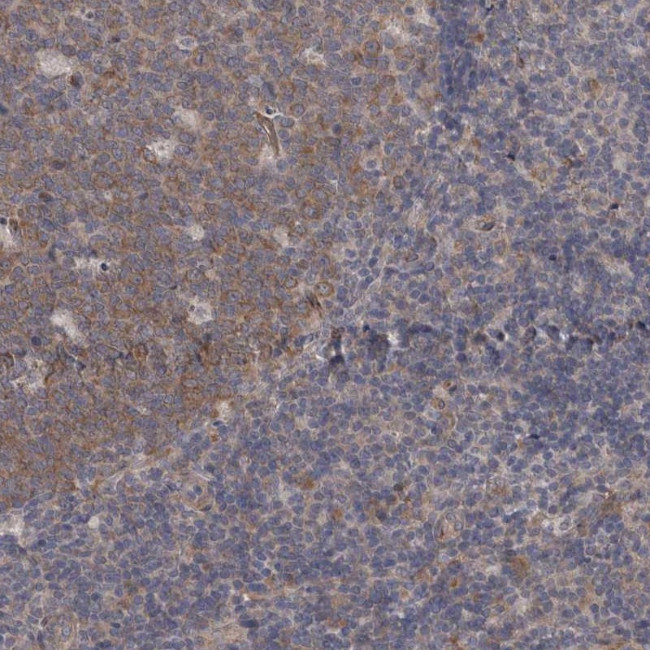 DDX6 Antibody in Immunohistochemistry (Paraffin) (IHC (P))